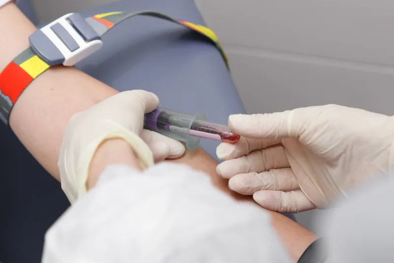 Zdjęcie RDW CV co to – co mówi o zdrowiu i diagnozie anemii?