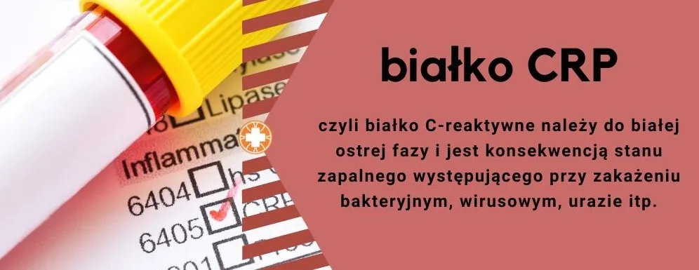 Zdjęcie Co to jest CRP i ile kosztuje badanie - praktyczny poradnik 2025