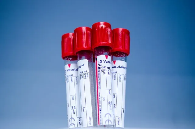 Zdjęcie HbA1c co to za badania i jak wpływa na zdrowie osób z cukrzycą