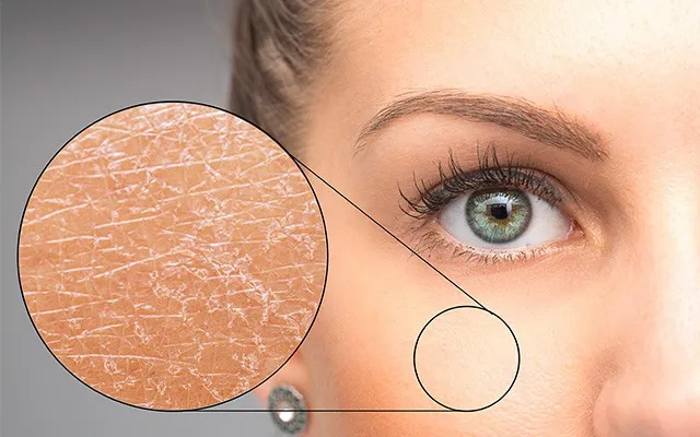 Zdjęcie Effektive Tipps: Was kann man gegen trockene Gesichtshaut machen?