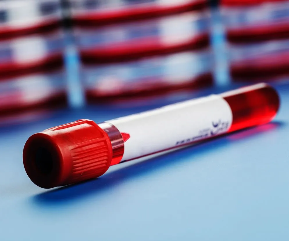 Zdjęcie Badanie D-dimerów: co to jest i dlaczego jest tak ważne w diagnostyce?