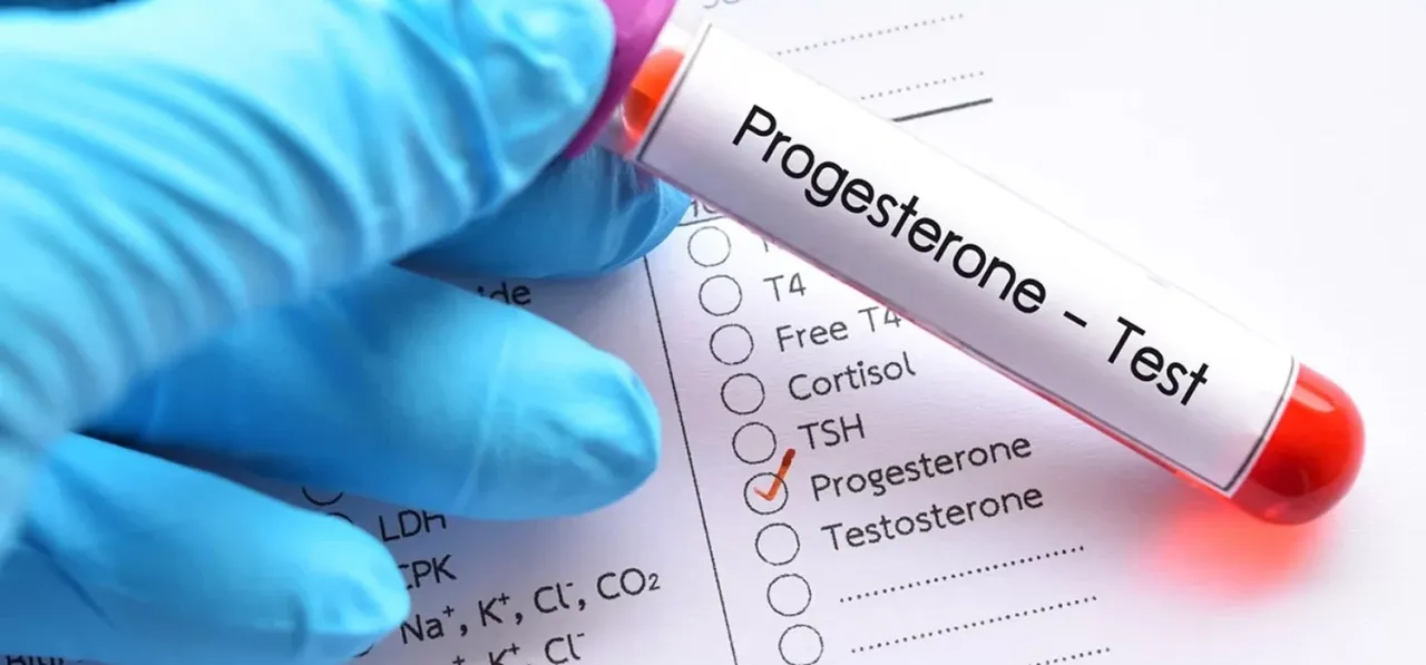 Zdjęcie Kiedy badać progesteron, aby uzyskać dokładne wyniki i uniknąć błędów