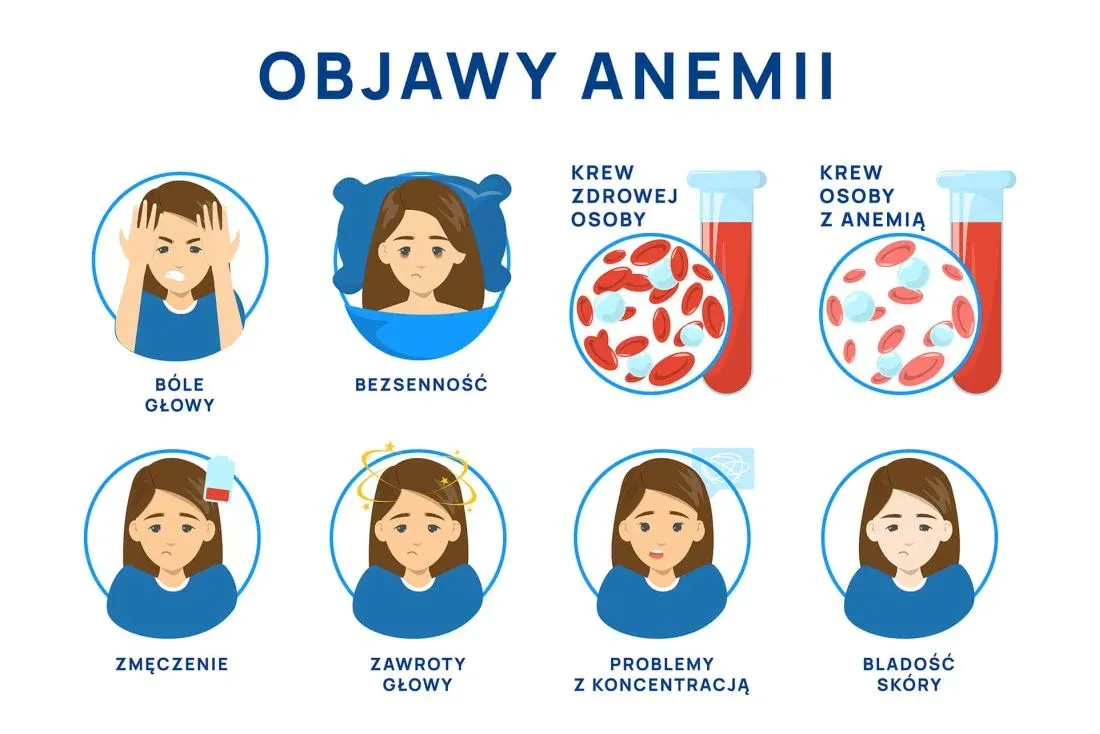 Zdjęcie Podwyższony poziom żelaza co oznacza? Objawy, przyczyny i leczenie