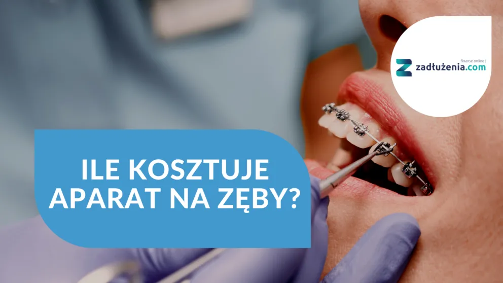 Zdjęcie Ile kosztuje aparat ortodontyczny? Ceny, które Cię zaskoczą