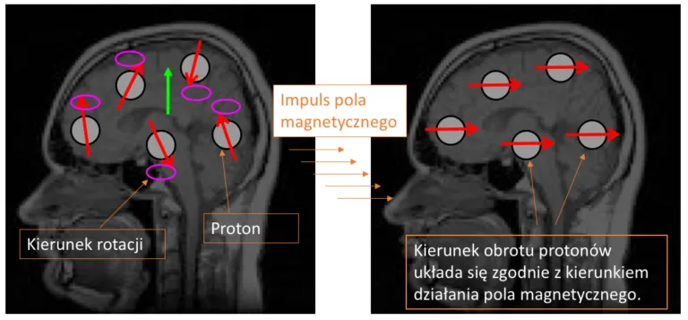 Zdjęcie Rezonans magnetyczny z hybrydami - czy to bezpieczne? Wyjaśniamy
