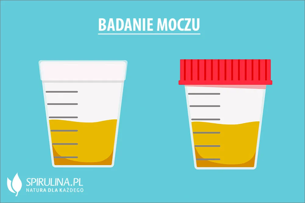 Zdjęcie Ile moczu do badania dziecka? Kluczowe informacje dla rodziców