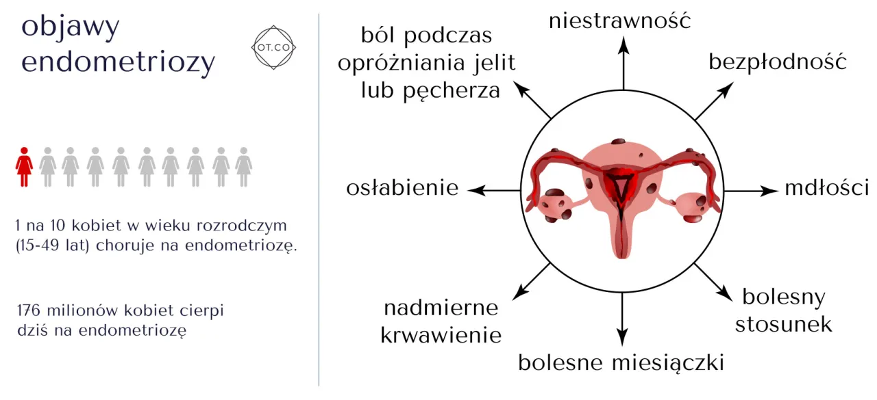 Zdjęcie Endometrioza objawy psychiczne: jak depresja i lęk wpływają na życie
