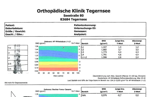 Zdjęcie Die entscheidenden Schritte zur Osteoporose Diagnostik verstehen