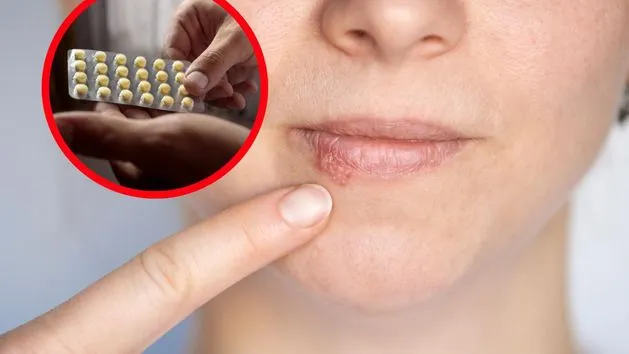 Zdjęcie Niedobór wit B2 objawy: Jak rozpoznać groźne sygnały organizmu