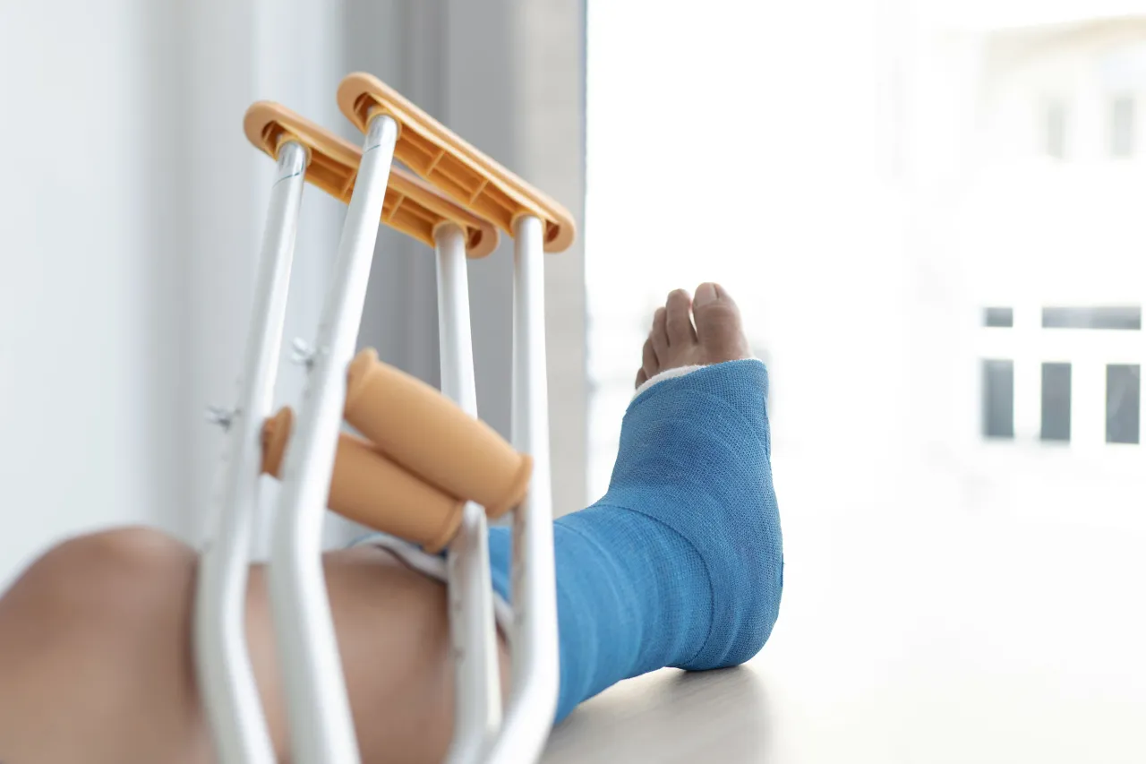 Zdjęcie Jak długo trwa rehabilitacja po złamaniu kostki? Poznaj kluczowe informacje.