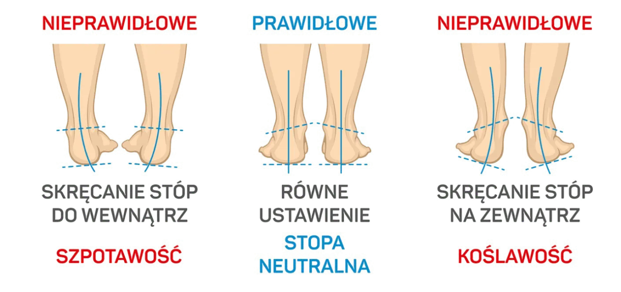 Zdjęcie Wiotkość stawów do jakiego lekarza? Sprawdź, co musisz wiedzieć