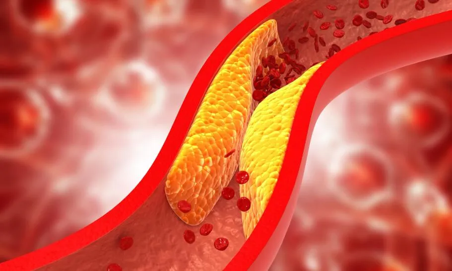 Zdjęcie Czy słodycze podnoszą cholesterol? Fakty, które musisz znać