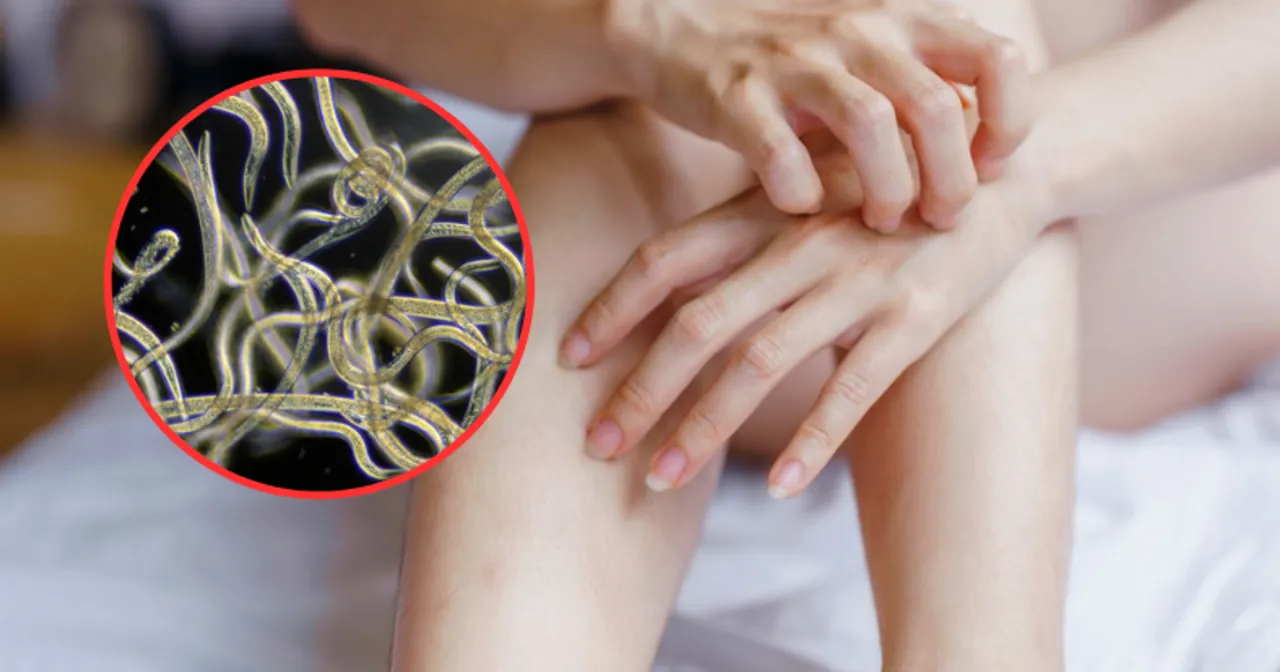 Zdjęcie Objawy odrobaczania: co może cię zaskoczyć po leczeniu?