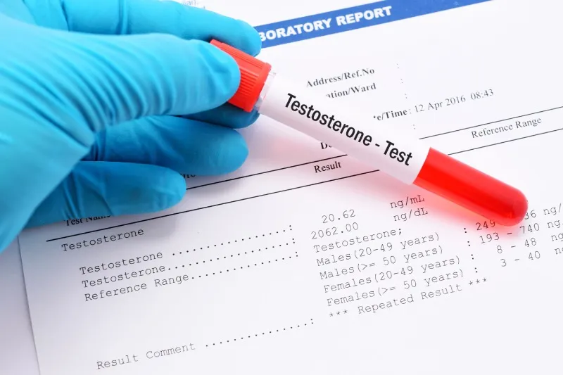 Zdjęcie Niepokojące objawy podwyższonego poziomu testosteronu: na co uważać