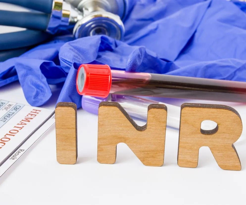 Zdjęcie Ile się czeka na wynik badania INR? Oto co musisz wiedzieć