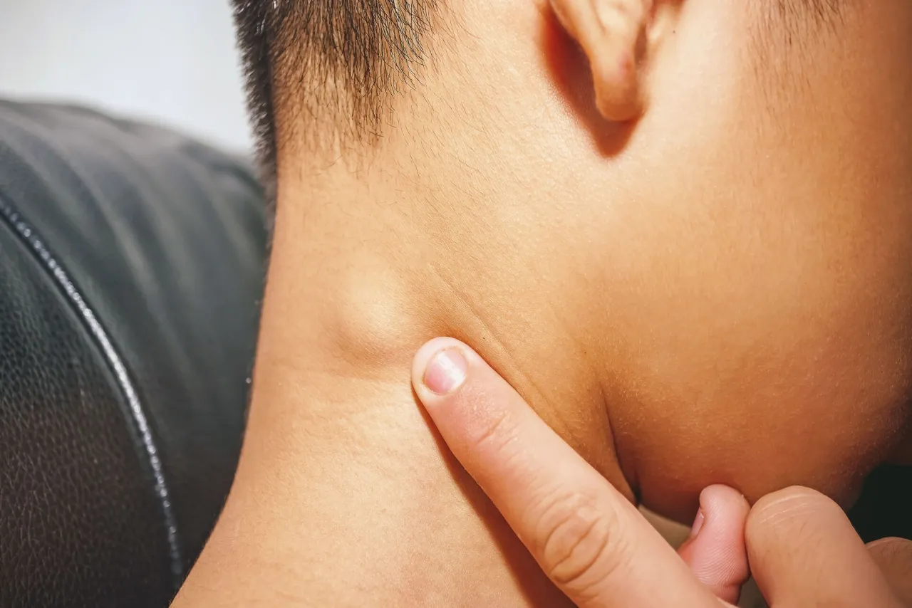 Zdjęcie Jakie badania krwi są niezbędne do diagnozy chłoniaka?