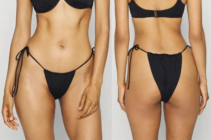 Zdjęcie Co obejmuje bikini brazylijskie? Zaskakujące szczegóły depilacji