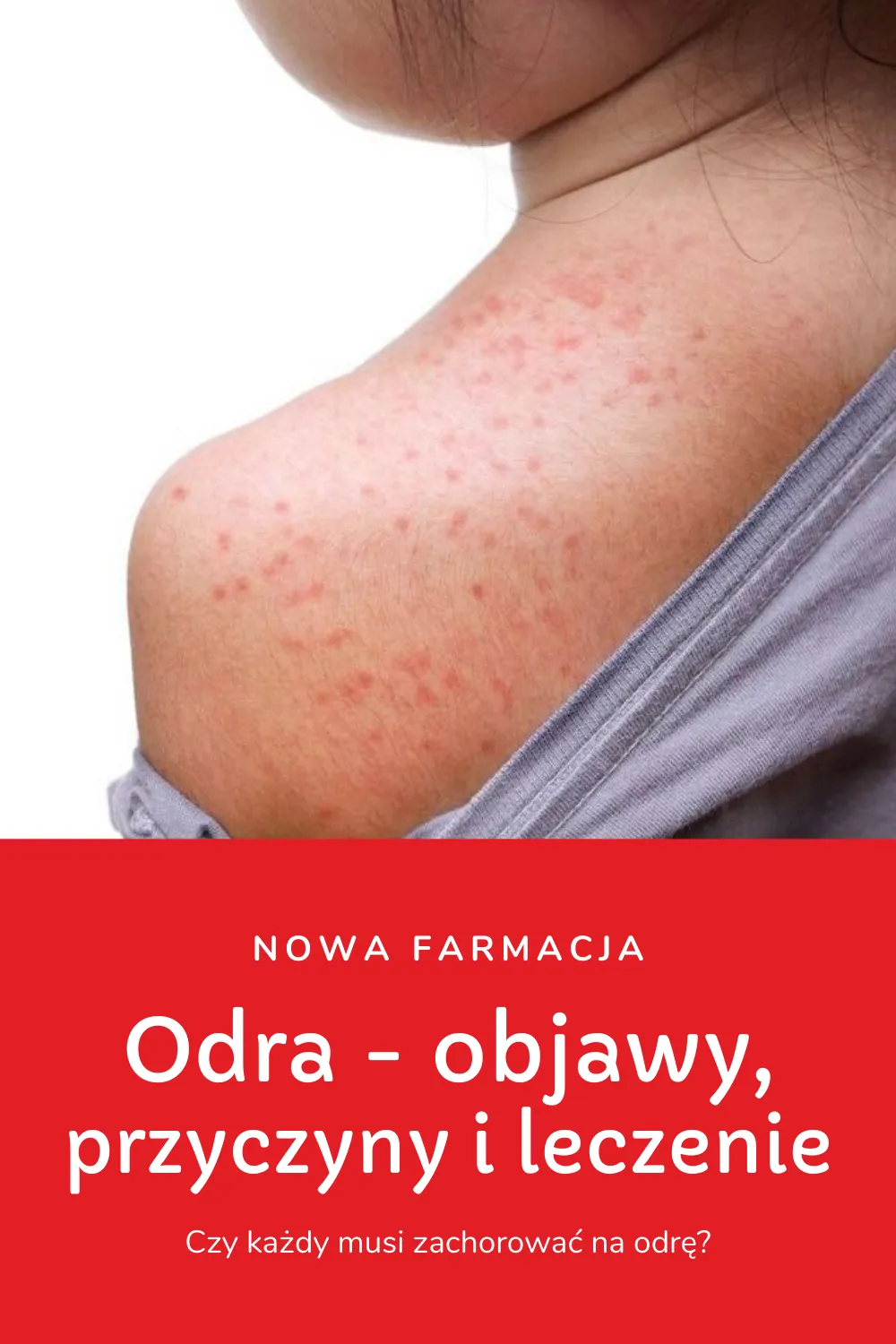 Zdjęcie Objawy odrobaczania u dzieci – jak rozpoznać infekcję pasożytniczą?