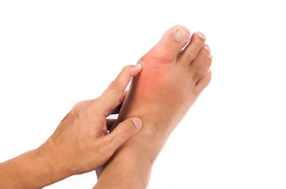 Zdjęcie Jaki lekarz leczy dnę moczanową i jak uniknąć bólu stawów