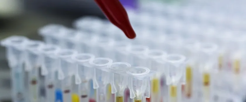 Zdjęcie Kiedy wykonać badania hormonalne? Kluczowe dni cyklu dla wyników