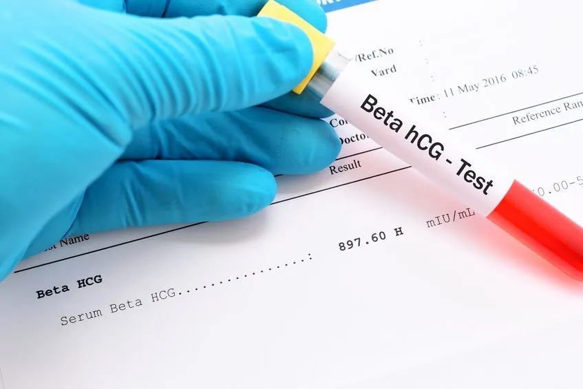 Zdjęcie Badanie bhcg u mężczyzny: kluczowy marker w diagnostyce raka jądra