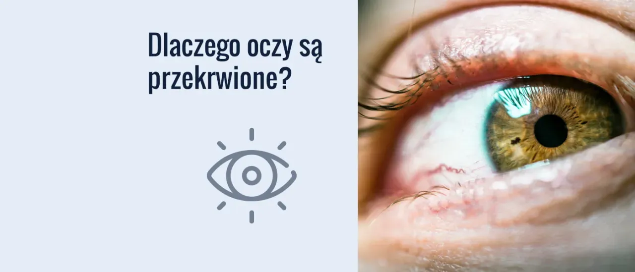 Zdjęcie Dlaczego koniom zasłania się oczy? Odkryj korzyści i zastosowania
