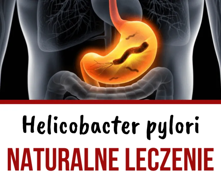 Zdjęcie Objawy zakażenia Helicobacter pylori – czym mogą być spowodowane?