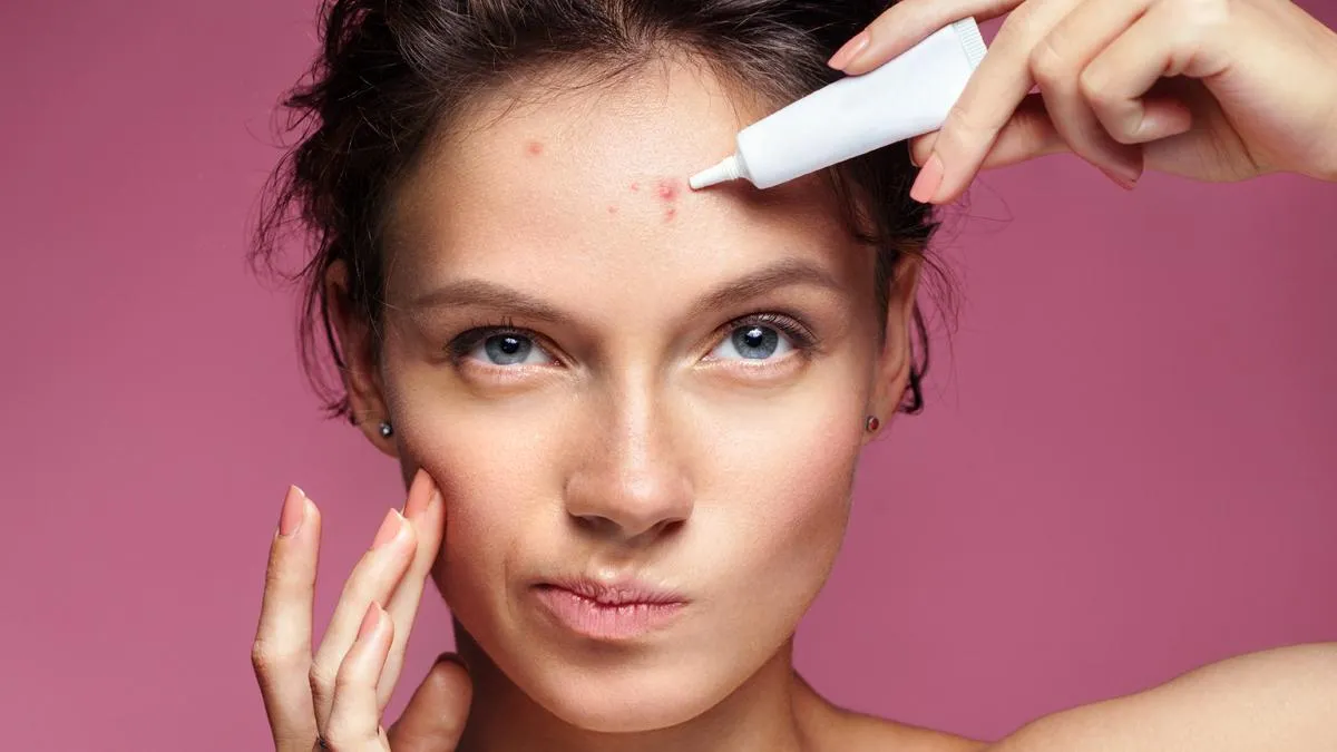 Zdjęcie Czy pasta pomaga na pryszcze? Dlaczego lepiej jej unikać i co stosować?