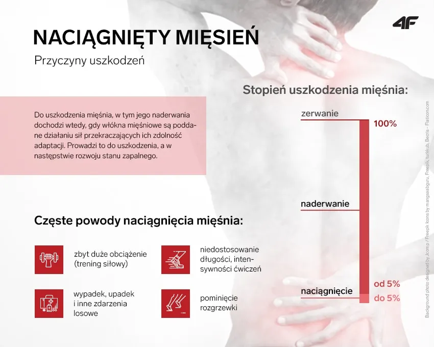 Zdjęcie Jakie są objawy naciągnięcia mięśnia łydki? Kompletny poradnik diagnostyki