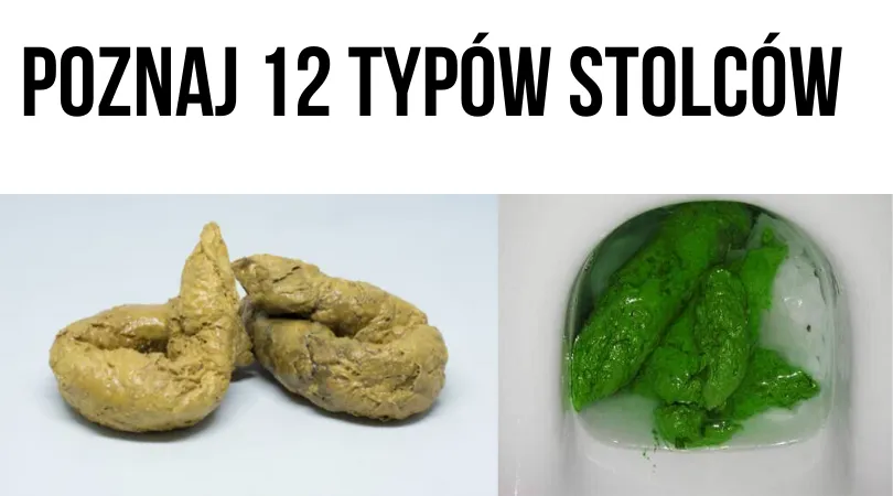 Zdjęcie Ciemnozielony kał u psa: Co to znaczy i kiedy martwić się?