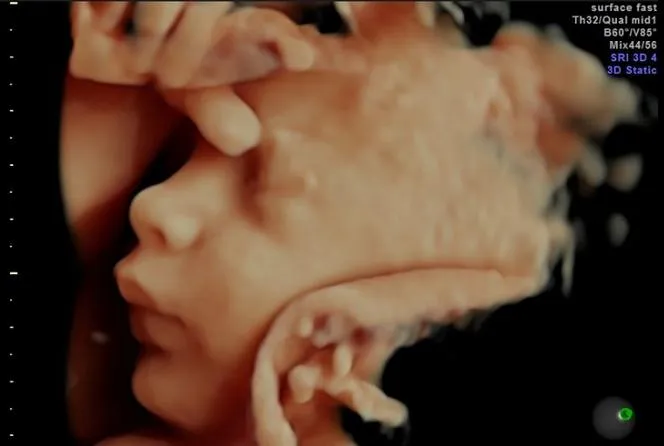 Zdjęcie Jak wyglądają badania połówkowe? Co musisz wiedzieć przed USG