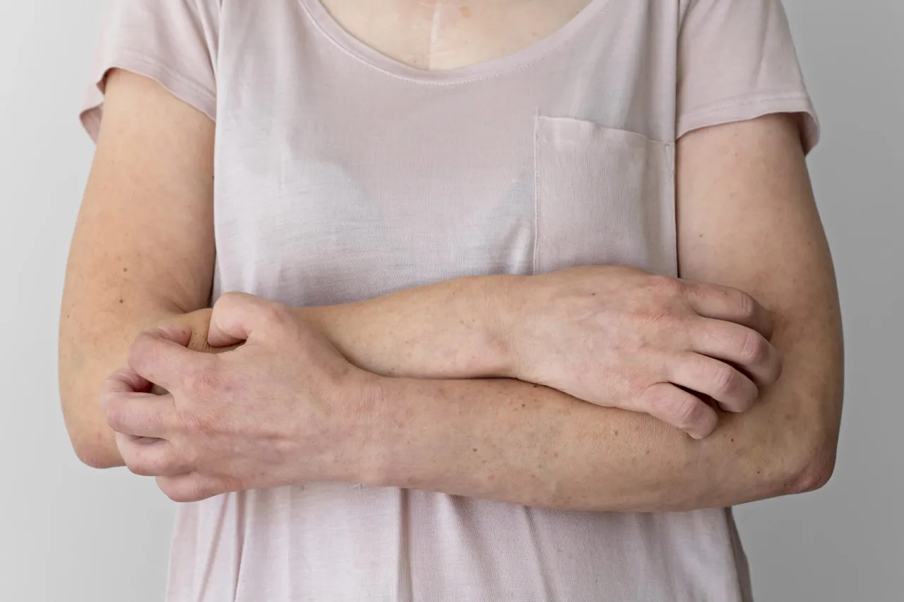 Zdjęcie Alergia na tle nerwowym objawy: jak stres wpływa na twoje zdrowie