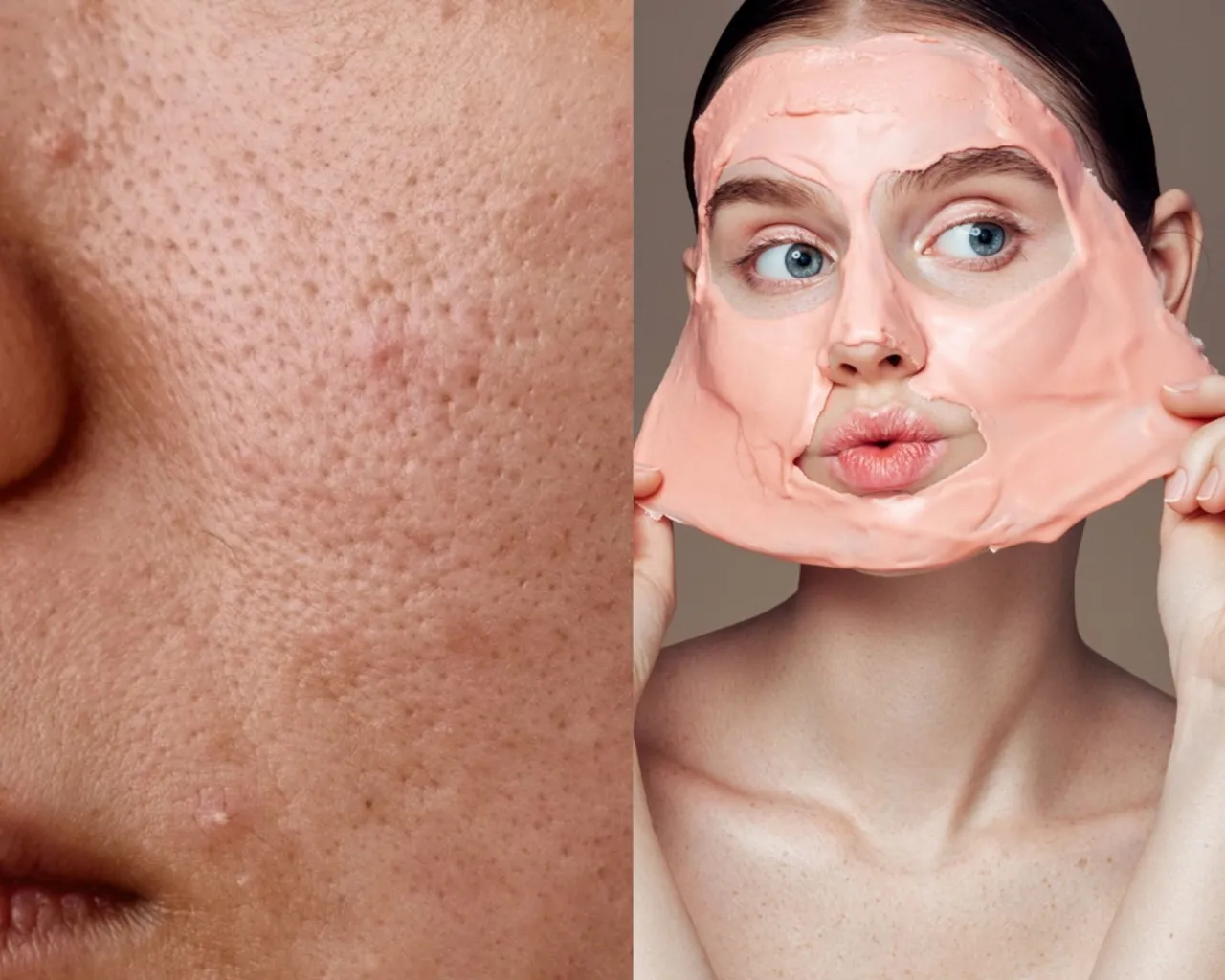 Zdjęcie Jak wygląda zapchana cera? Rozpoznaj objawy i skutecznie ją oczyść