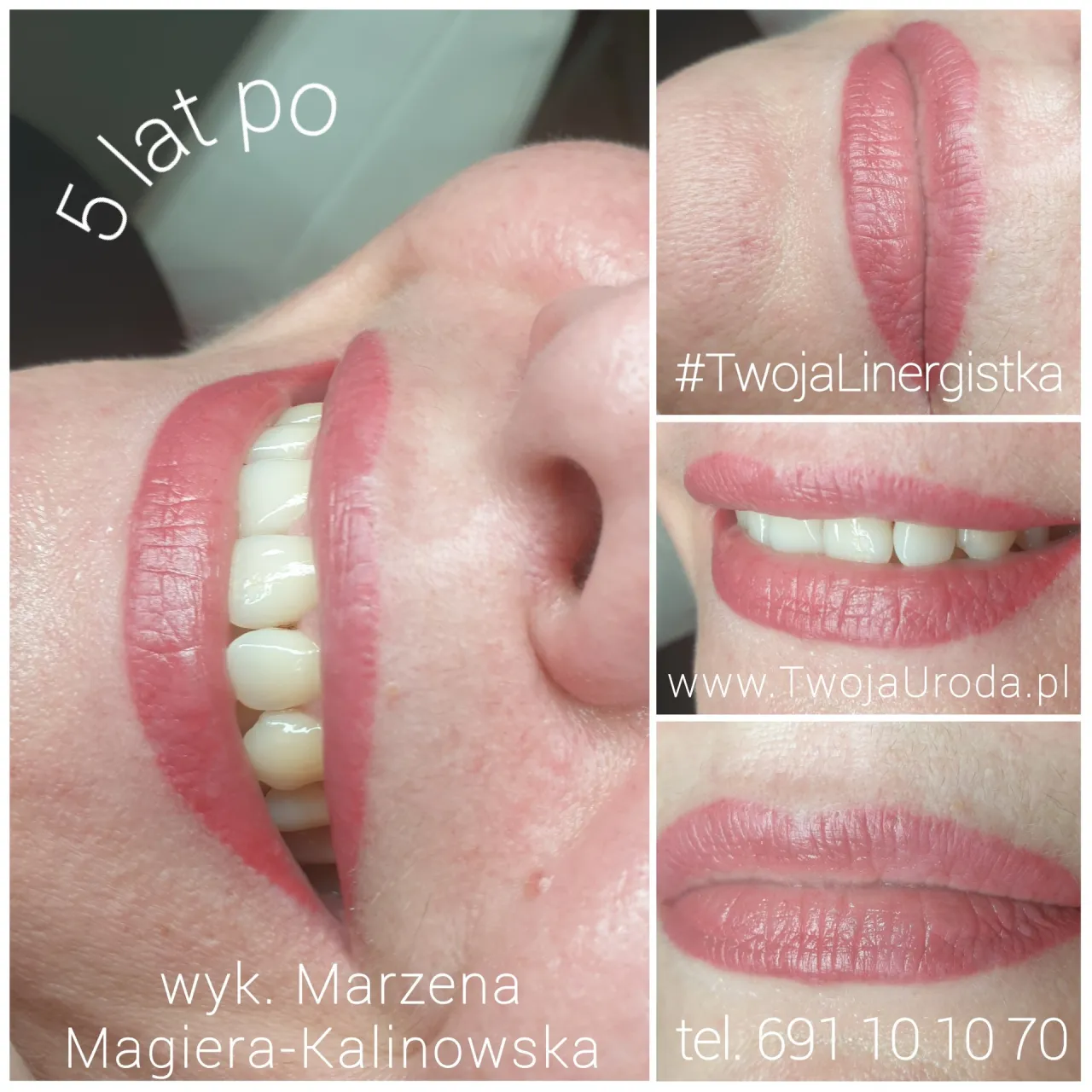 Zdjęcie Ile się goją usta po makijażu permanentnym? Poznaj cały proces