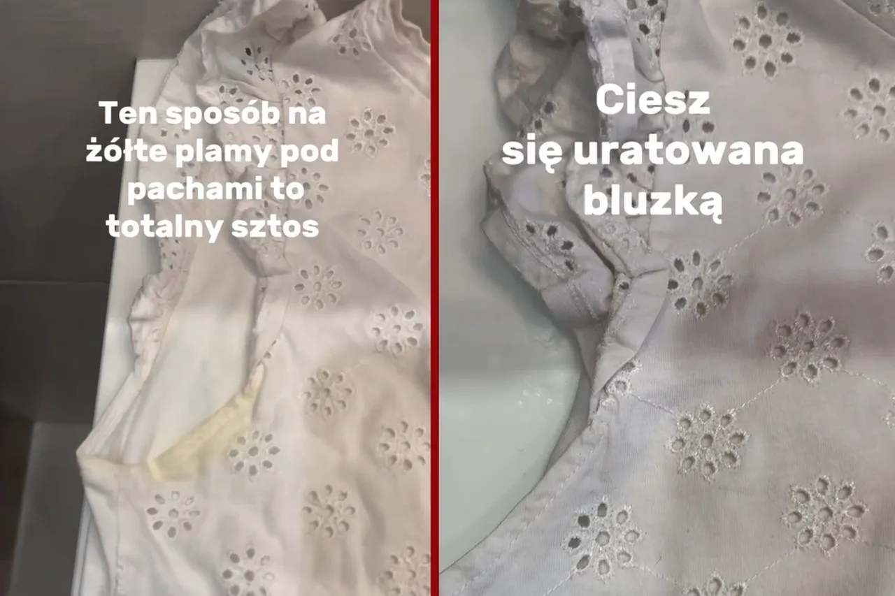 Zdjęcie Jak wywabić żółte plamy z białej bluzki - skuteczne metody na trudne plamy