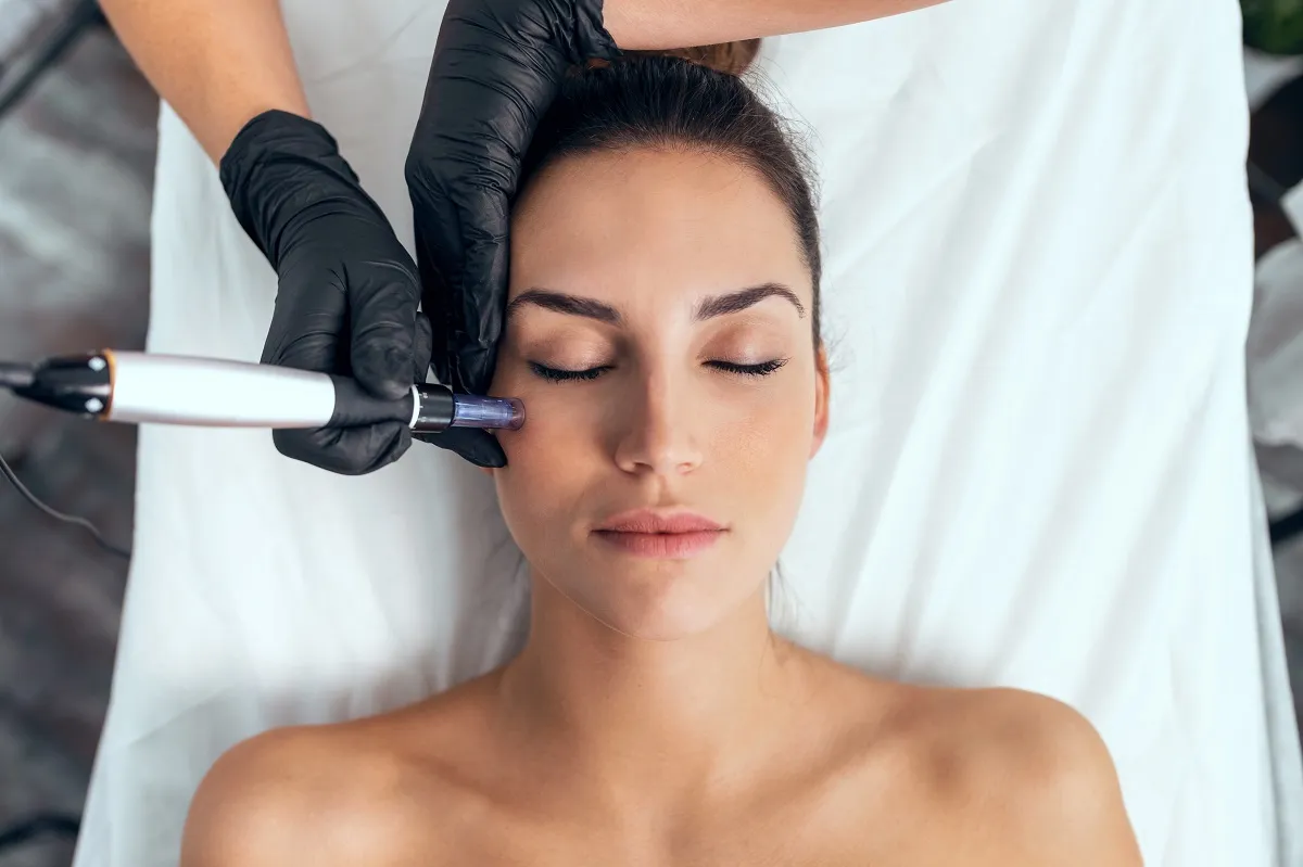Zdjęcie Co lepsze: dermapen czy laser frakcyjny - porównanie efektów i korzyści