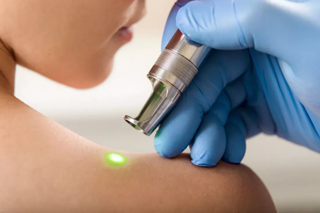 Zdjęcie Jak działa laser w rehabilitacji i jakie przynosi korzyści?