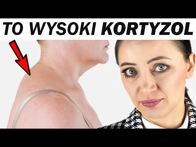 Zdjęcie Podwyższony poziom kortyzolu – poznaj objawy i zagrożenia dla zdrowia