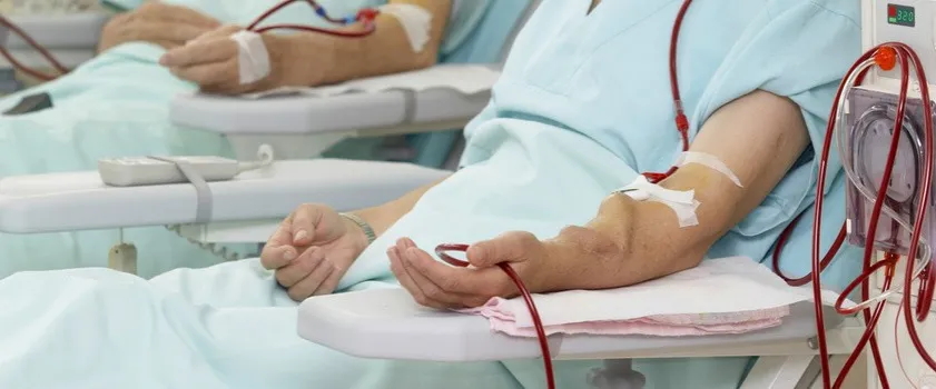 Zdjęcie Podwyższony poziom mocznika i kreatyniny: przyczyny, objawy i leczenie