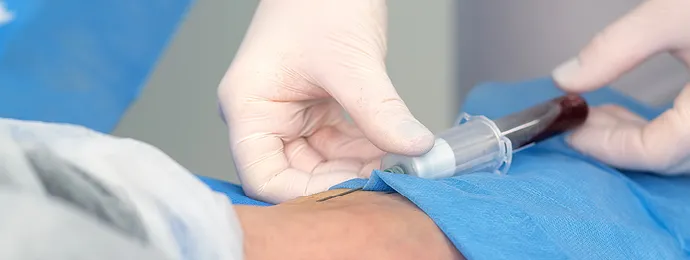 Zdjęcie Badanie E2 co to jest i dlaczego jest kluczowe dla zdrowia hormonalnego