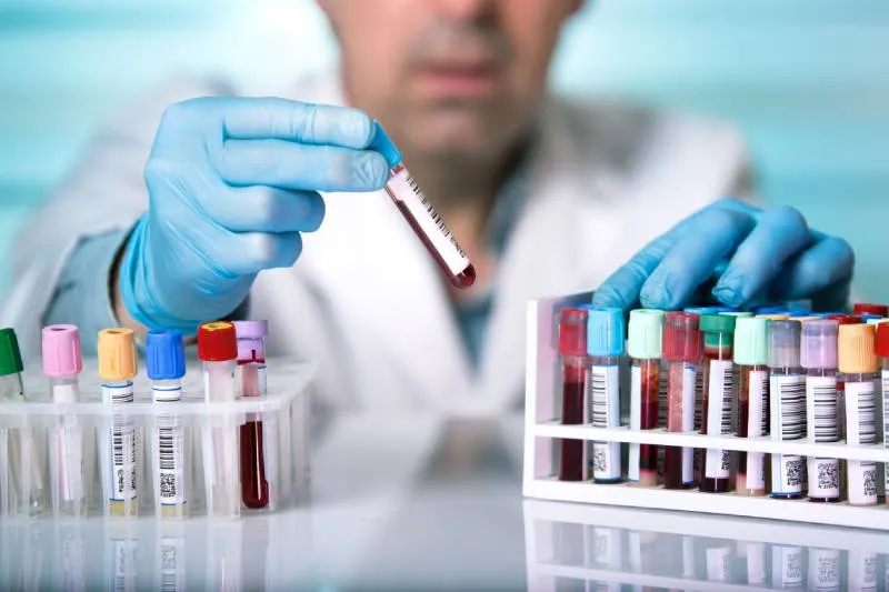 Zdjęcie Czy badania krwi wykryją raka? Fakty i ograniczenia diagnostyki