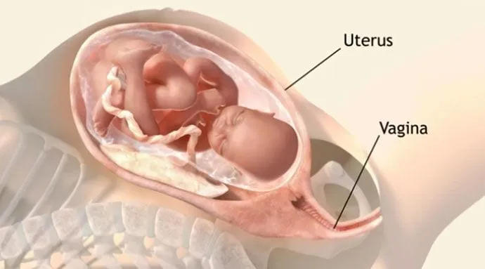 Zdjęcie Jak przebiega poród pośladkowy? Kluczowe informacje i ryzyka.