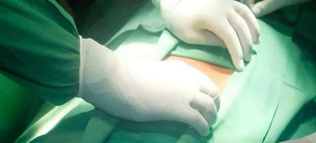 Zdjęcie  Jak długo trwa operacja wyrostka robaczkowego? Odpowiedź