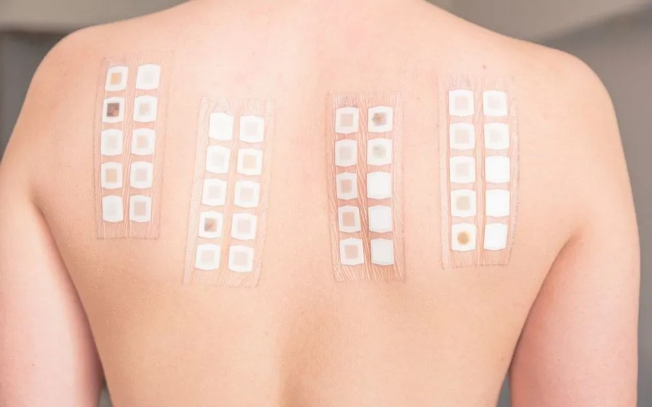 Zdjęcie Czy jagua uczula? Dowiedz się, jak unikać alergicznych reakcji