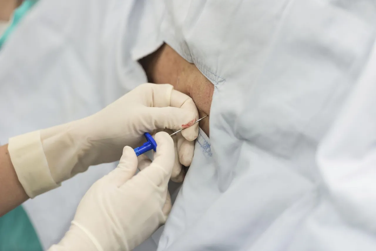 Zdjęcie Czy znieczulenie przy porodzie jest bezpieczne? Oto, co musisz wiedzieć