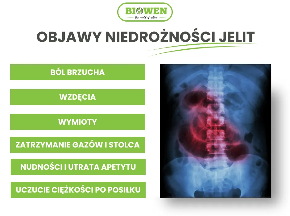Zdjęcie Niedrożność porażenna jelit objawy: Jak rozpoznać groźne symptomy