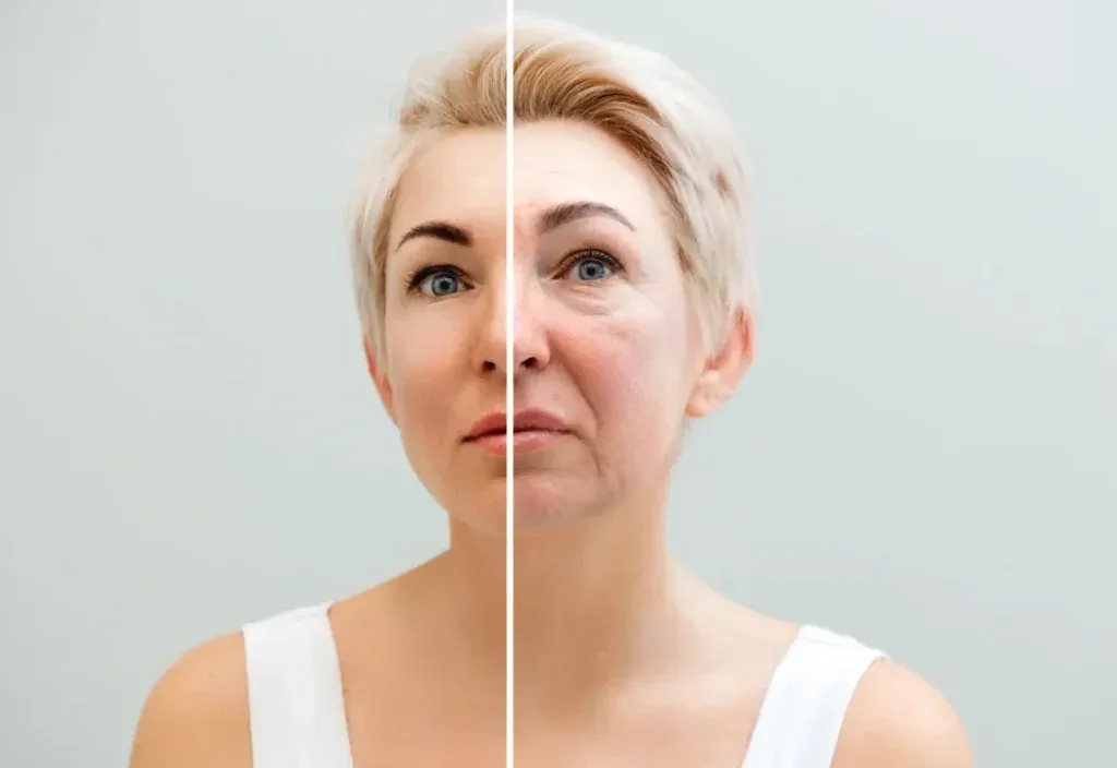 Zdjęcie Niedobór kolagenu objawy: jak rozpoznać skutki braku kolagenu