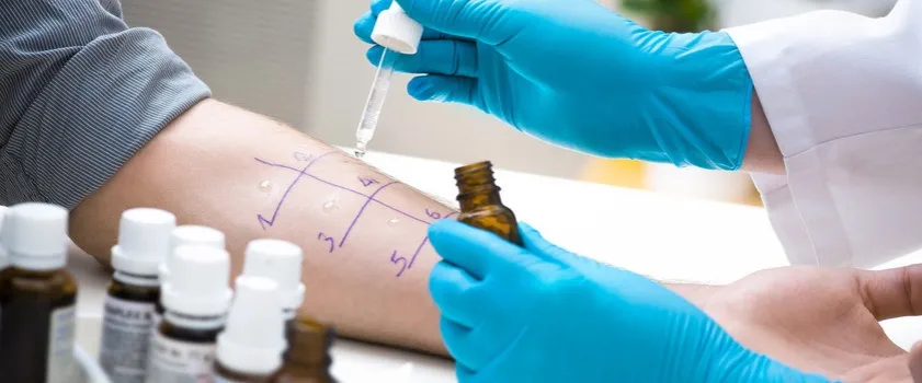 Zdjęcie Czy alergia to choroba? Odkryj prawdę o jej skutkach zdrowotnych