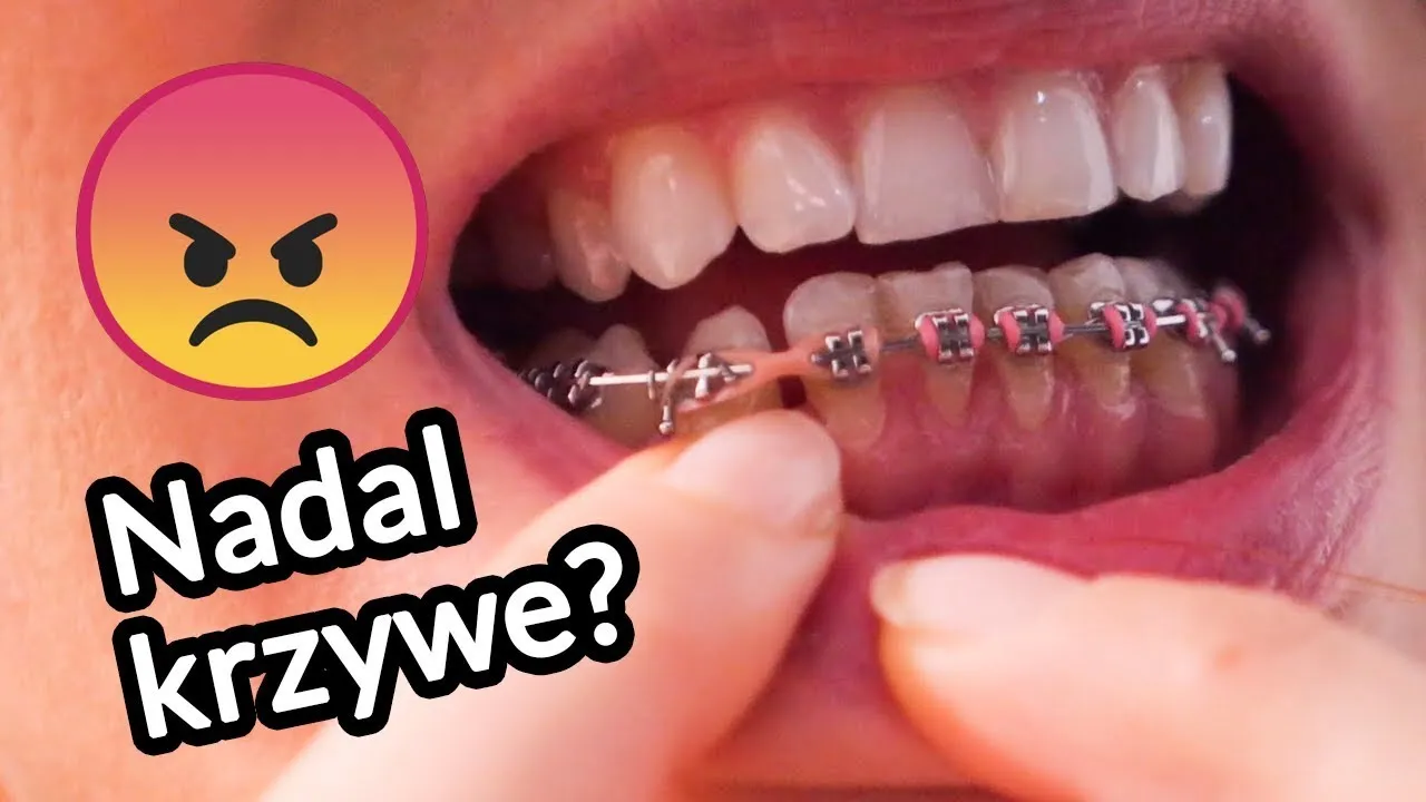 Zdjęcie Gdzie najtaniej zrobić zęby? Porównanie kosztów i jakości leczenia za granicą