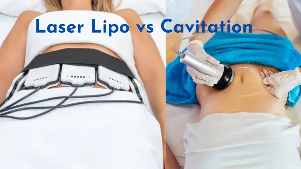 Zdjęcie Co lepsze: lipolaser czy liposukcja kawitacyjna – porównanie skuteczności